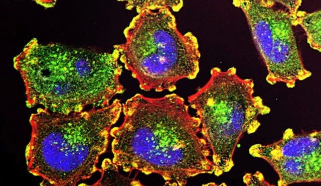 Melanoma Cells