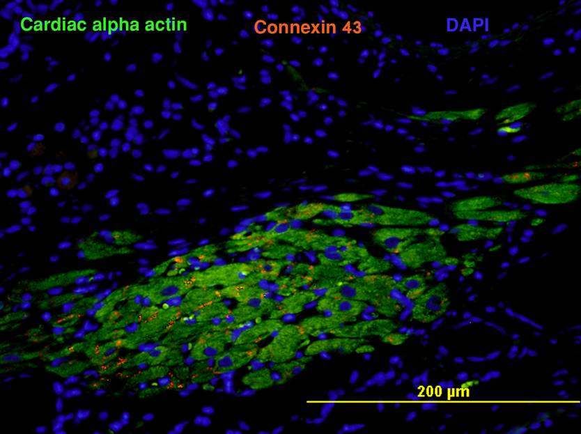 cardiac alpha actin connexin 43