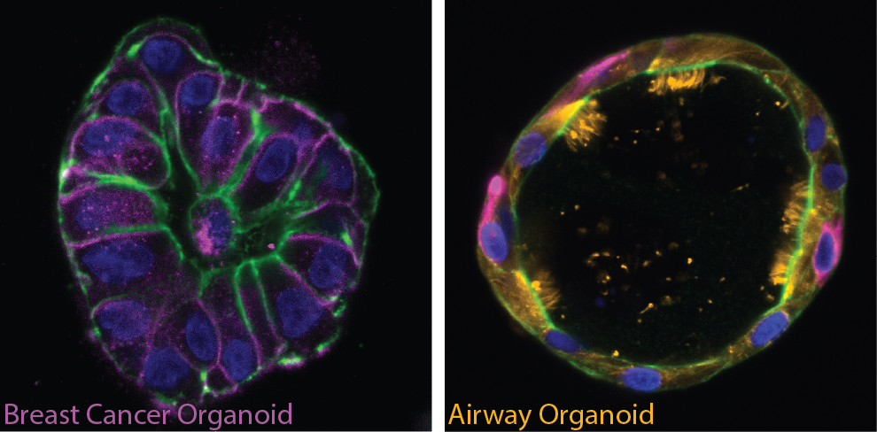 cancer cell plasticity and trans differentiation therapy lab | Sheba ...