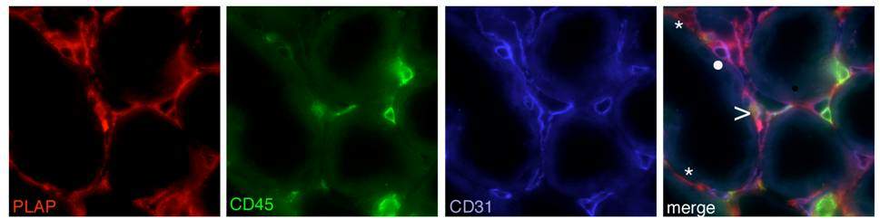 Generation of new vessels in the injured kidney following injection of bone-marrow derived stem cells