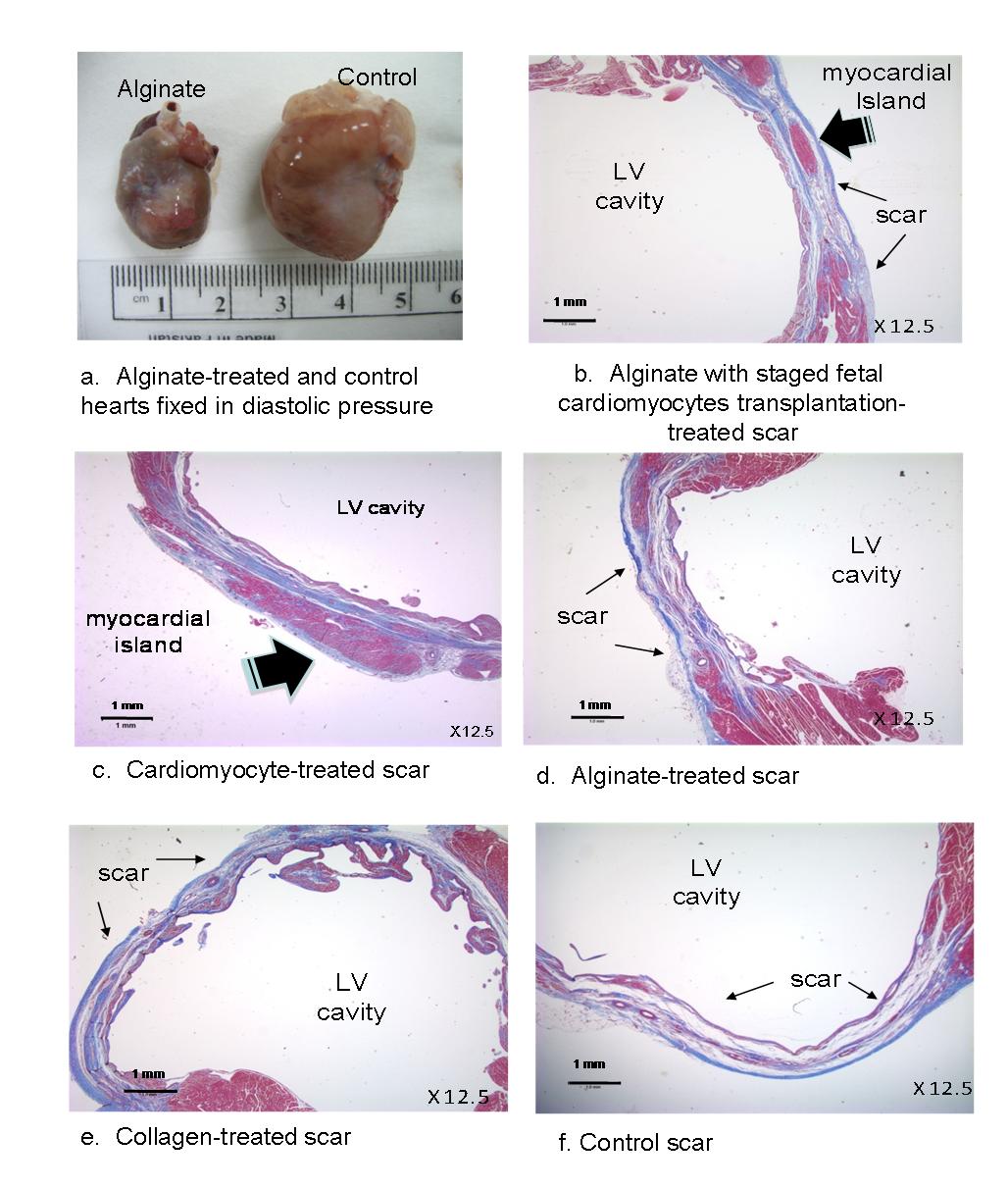 Tissue engineering
