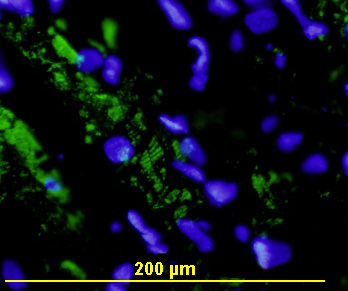 Stem cell studies that entail cardiac stem cells
