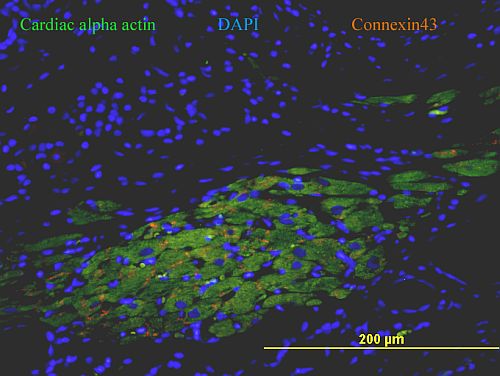 Reprogramming of cells ex vivo and in situ