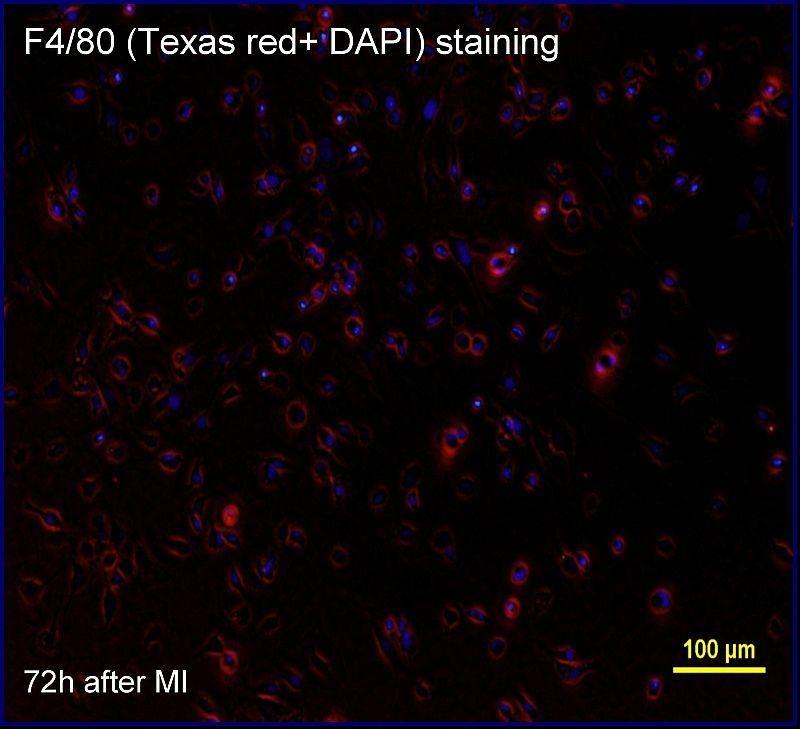 Molecular imaging cell tracking and inflammation in the heart