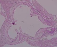 Atherosclerosis Immunohistochemistry of aortic root of a representative apoE